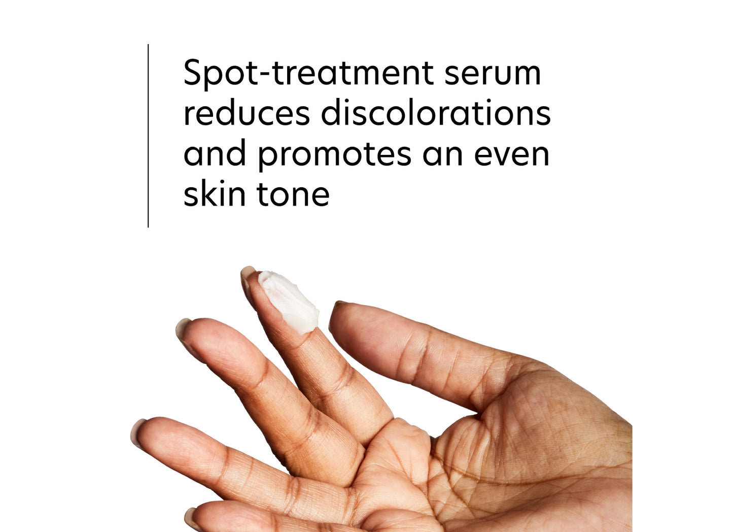 Spot-treatment serum reduces discolorations and promotes an even skin tone