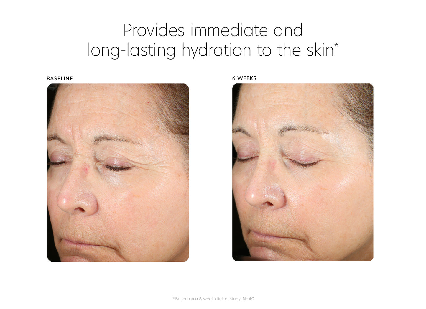 Before and after 6 weeks. Provides immediate and long-lasting hydration to the skin