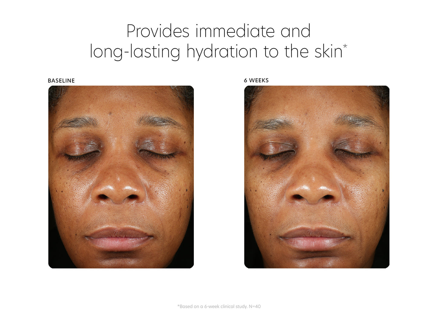 Before and after 6 weeks. Provides immediate and long-lasting hydration to the skin