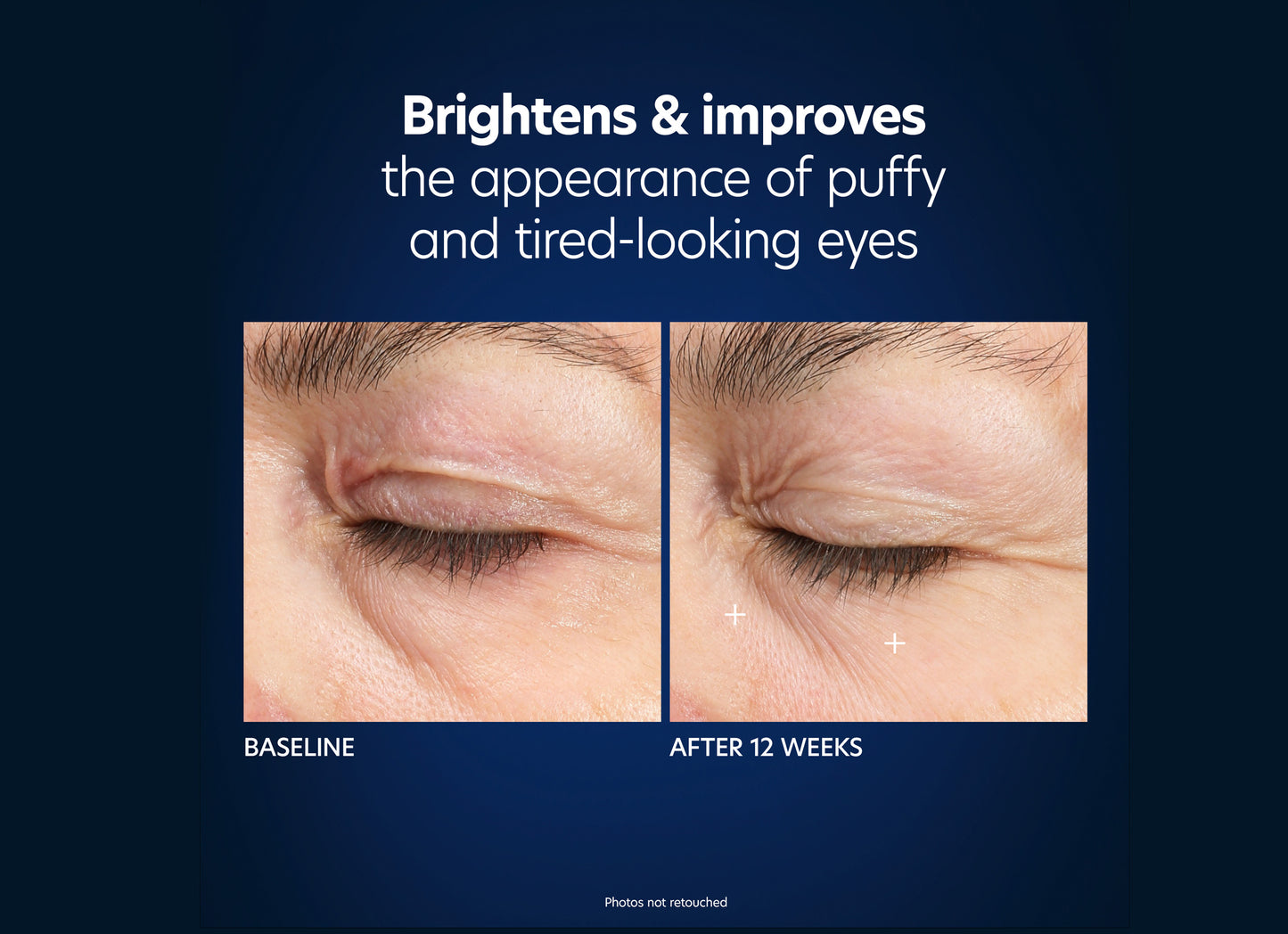 Brightens & improves the appearnce of puffy eyes