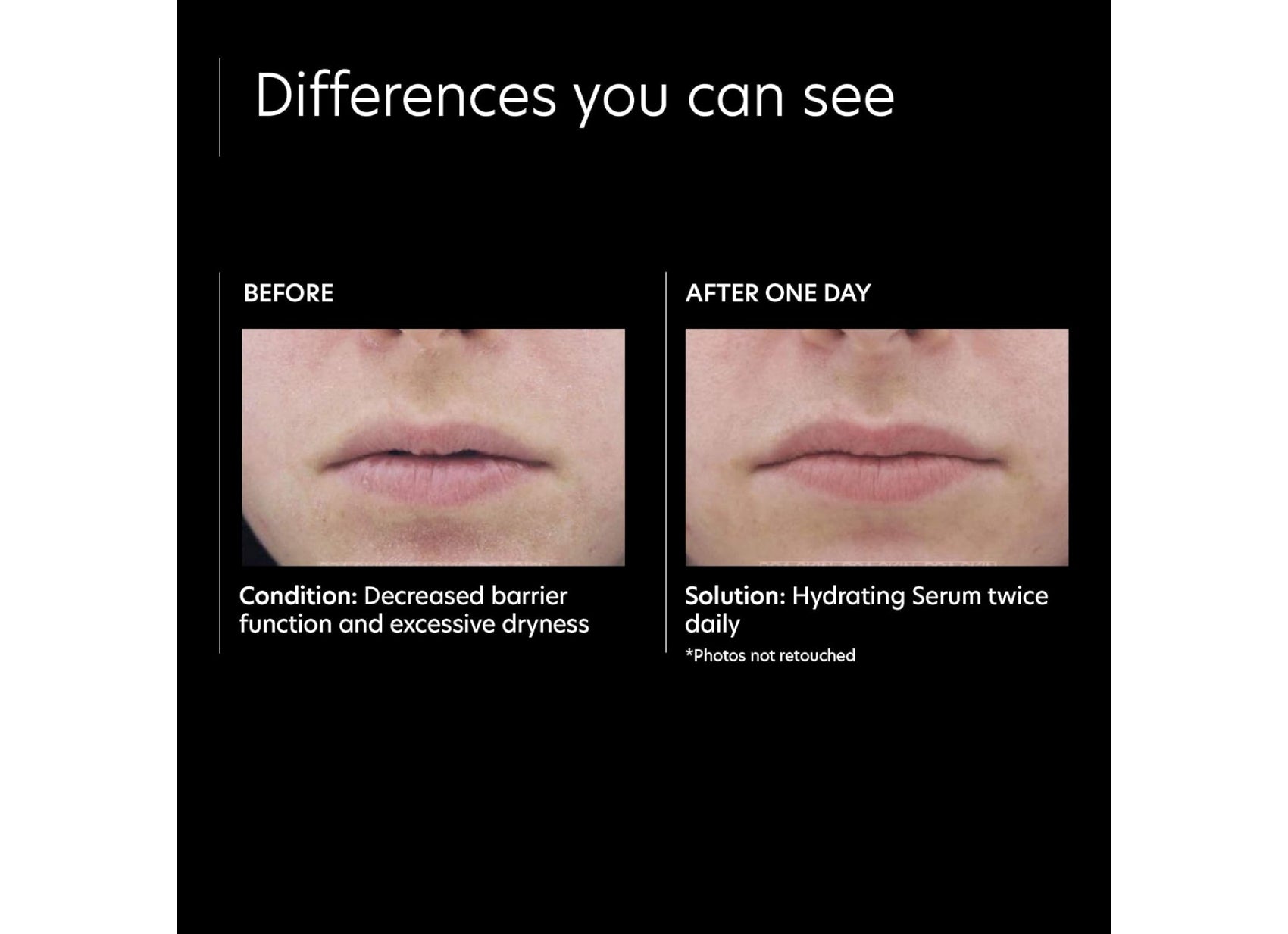 Before and after