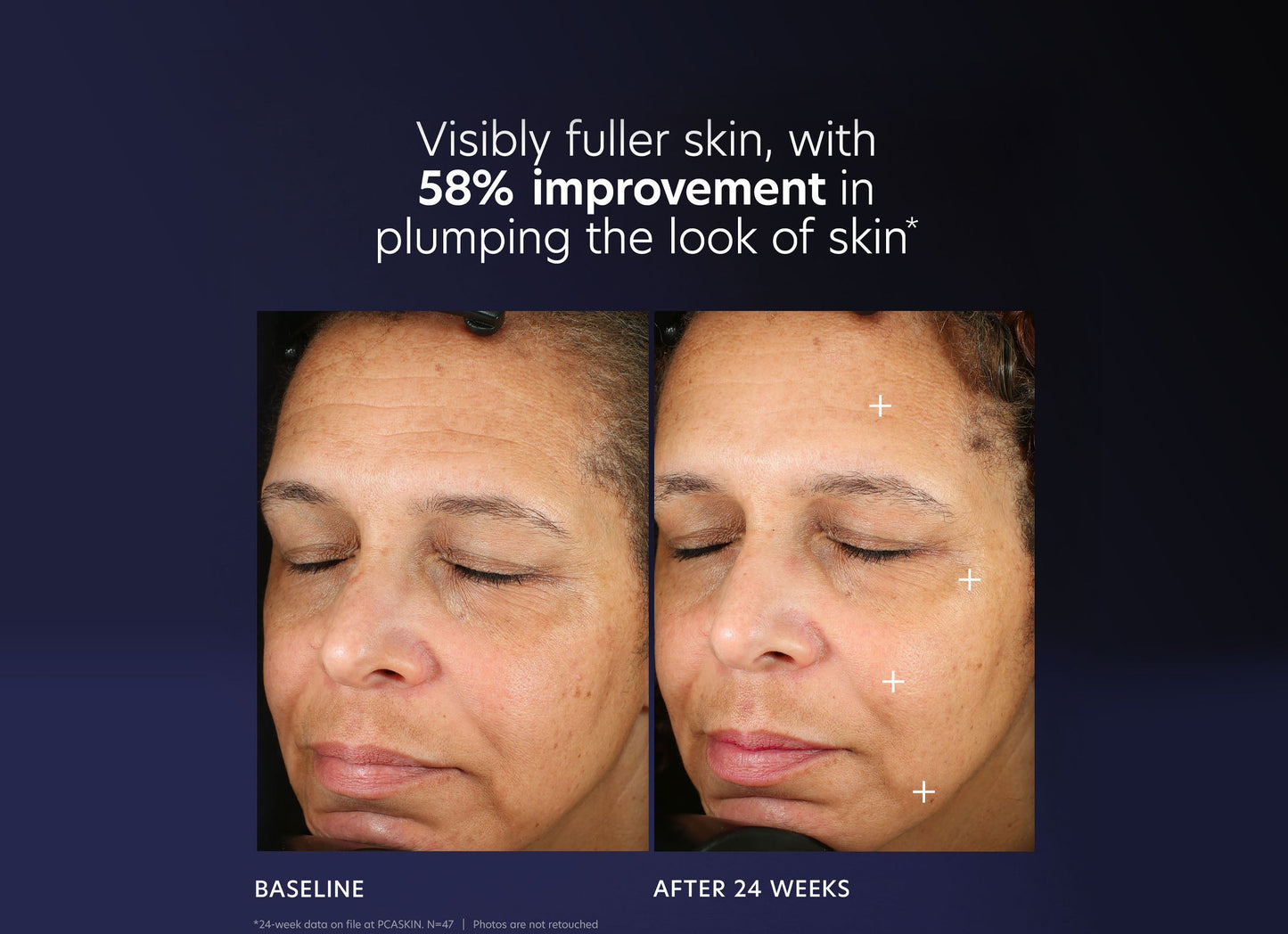 Pro-Max Age Renewal. B&A 58% Improvement